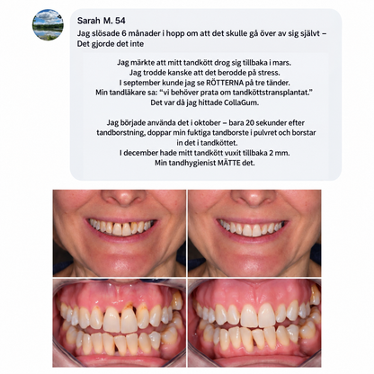 GumGuard™ | Dagligt kollagenstöd för starkare och friskare tandkött
