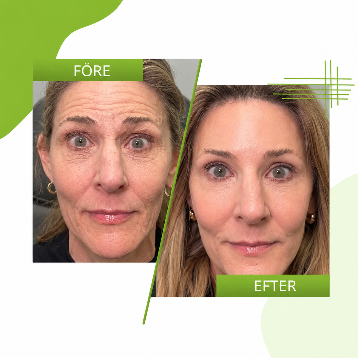DermaLind™ | Uppstramande ansiktskräm för slätare & fastare hud
