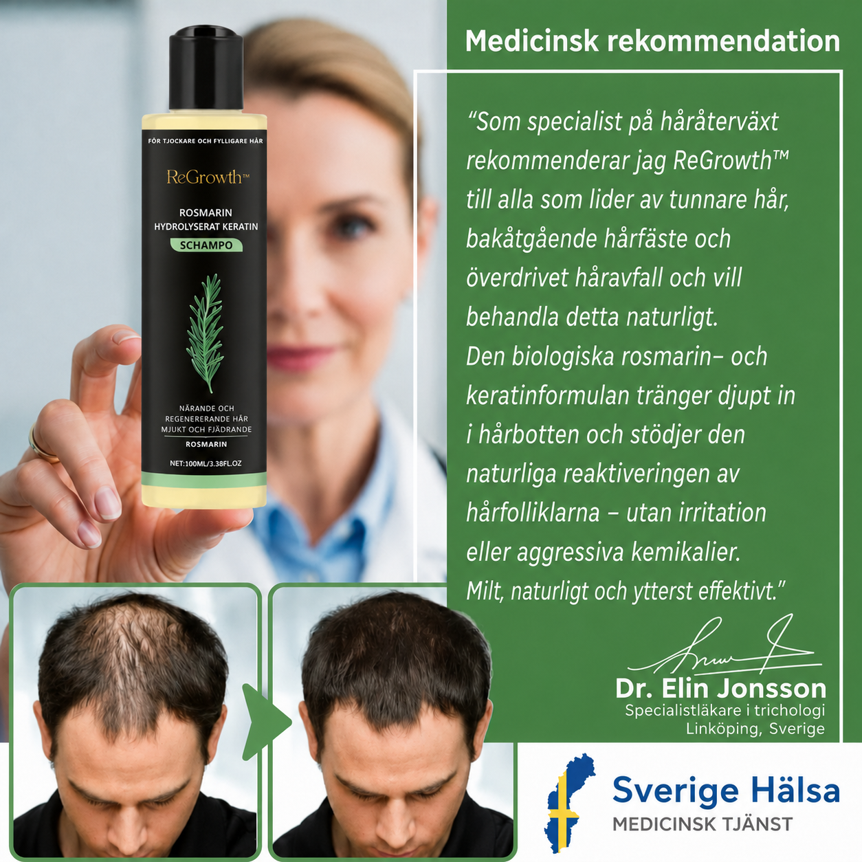ReGrowth™ | Uppnå tjockare, fylligare hår på bara 2 veckor!