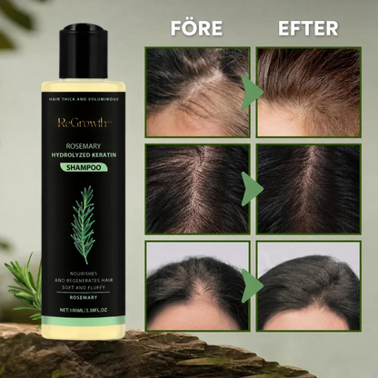 ReGrowth™ | Uppnå tjockare, fylligare hår på bara 2 veckor!