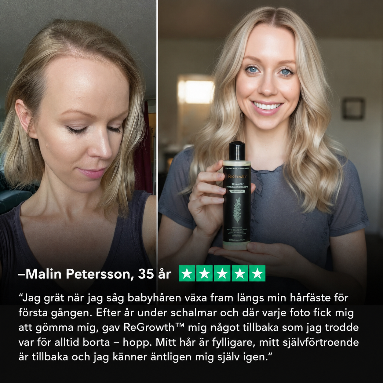 ReGrowth™ | Uppnå tjockare, fylligare hår på bara 2 veckor!
