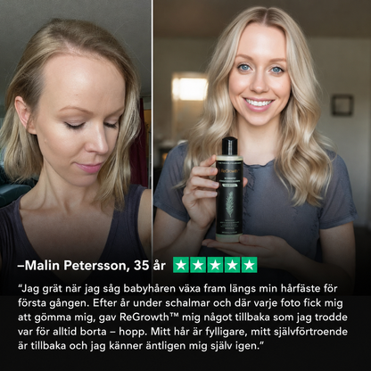 ReGrowth™ | Uppnå tjockare, fylligare hår på bara 2 veckor!