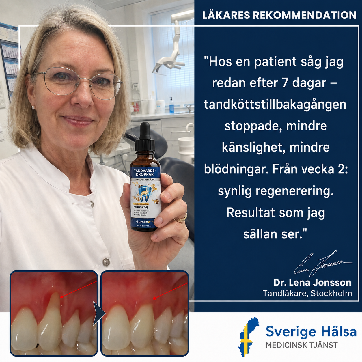 Gumline™ | Stoppa tandköttsretraktion med bivenomens uråldriga kraft — på bara 7 dagar