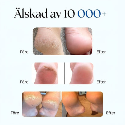 Hälva® | Reparerar Spruckna Hälar & Tar Bort Hård Hud