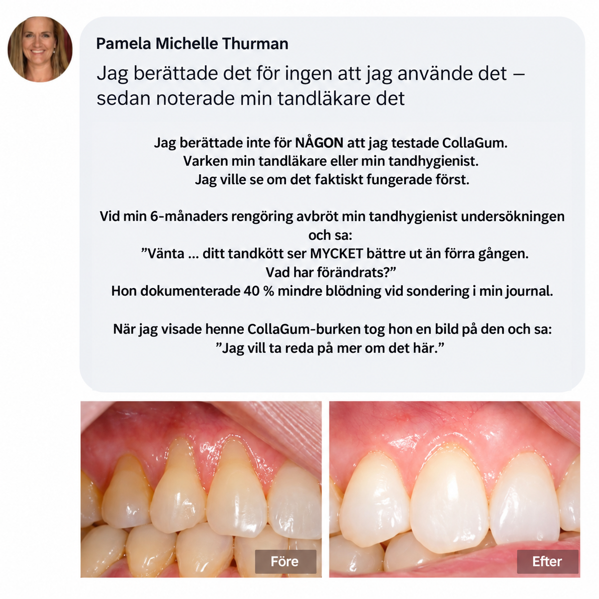 GumGuard™ | Dagligt kollagenstöd för starkare och friskare tandkött