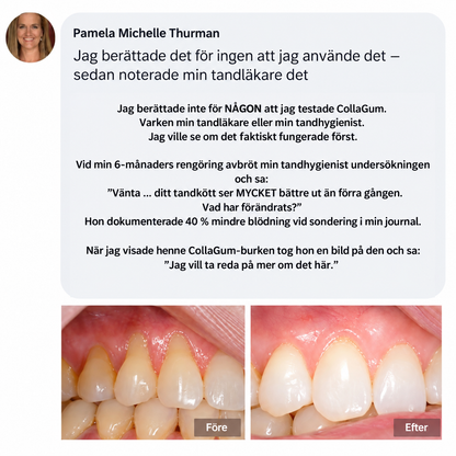 GumGuard™ | Dagligt kollagenstöd för starkare och friskare tandkött
