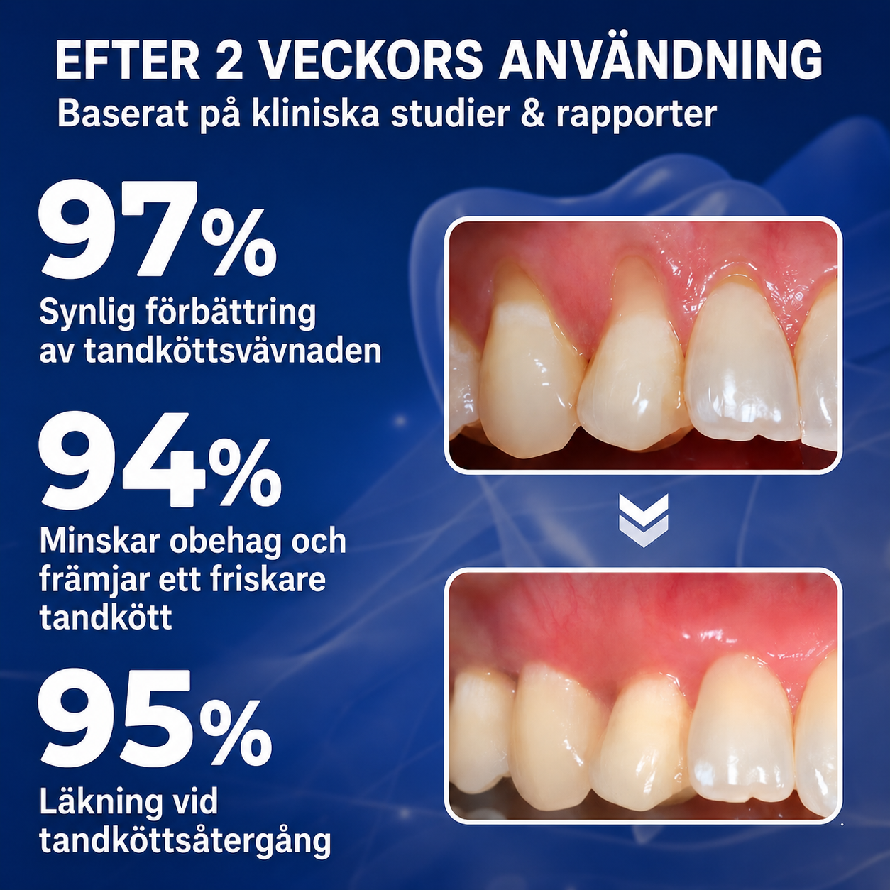 Gumline™ | Stoppa tandköttsretraktion med bivenomens uråldriga kraft — på bara 7 dagar
