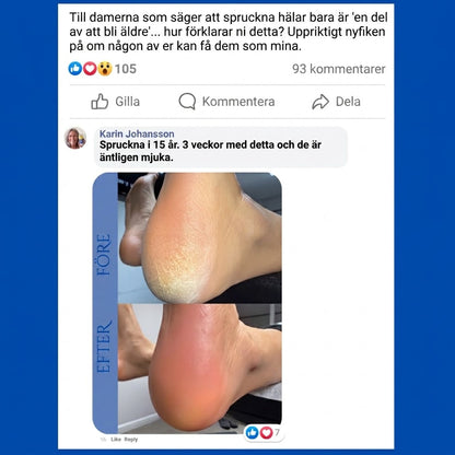 Hälva® | Reparerar Spruckna Hälar & Tar Bort Hård Hud
