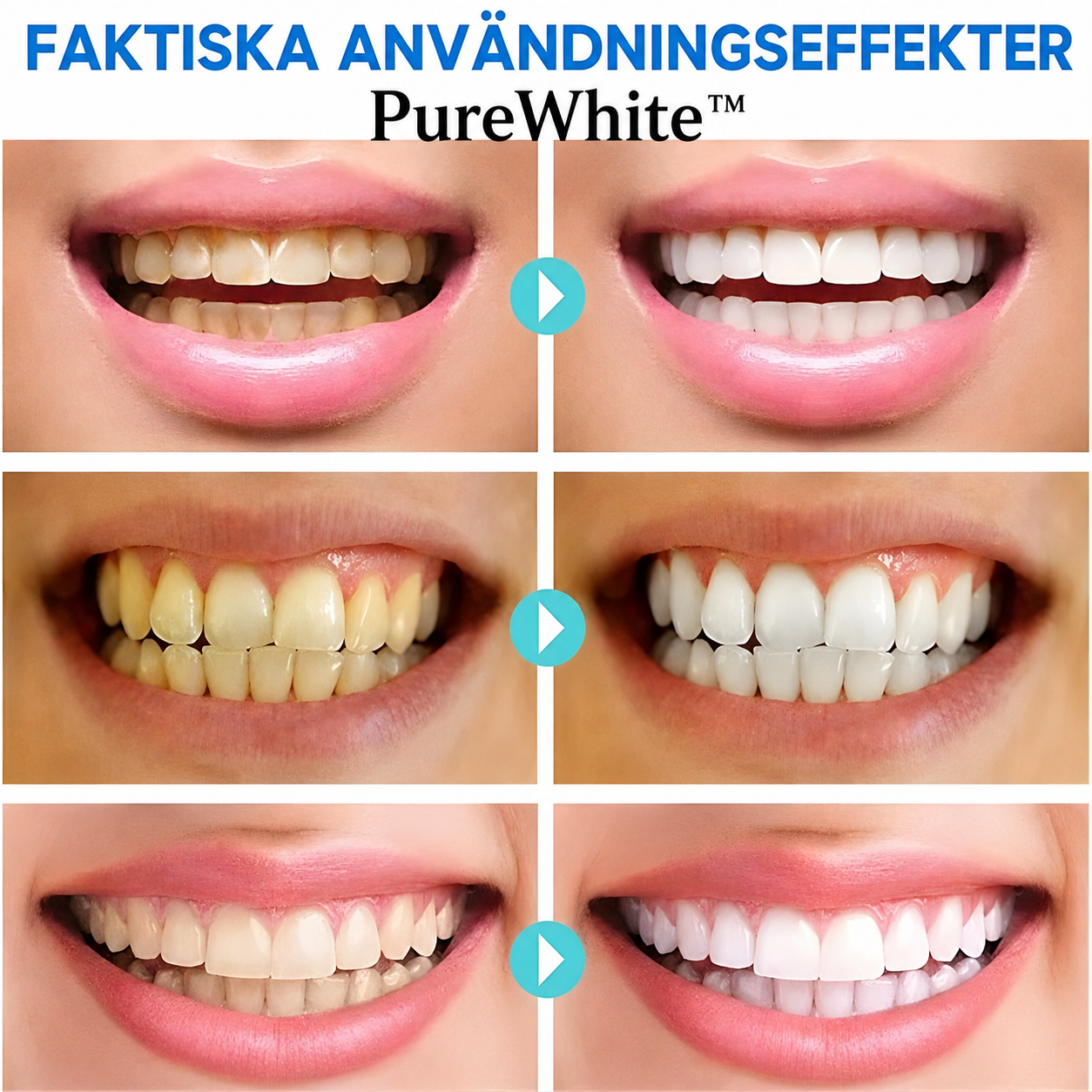 PureWhite™ | Blekande tandkräm med niacinamid – omedelbar effekt