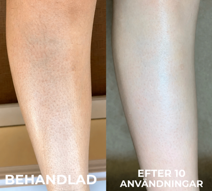 Strawberry Skin™ | Keratosis Pilaris-återfuktande kräm