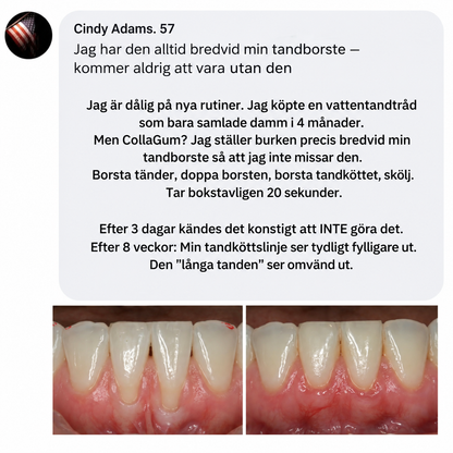 GumGuard™ | Dagligt kollagenstöd för starkare och friskare tandkött
