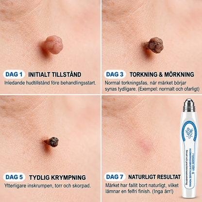 HudRen™ | Effektivt serum mot vårtor och hudförändringar