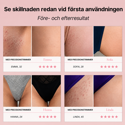 SilkTrim™ - Precisionstrimning för känsliga områden